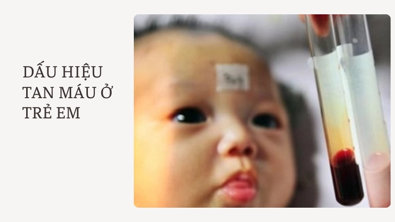 Dấu hiệu sớm dễ bị bỏ qua ở trẻ em