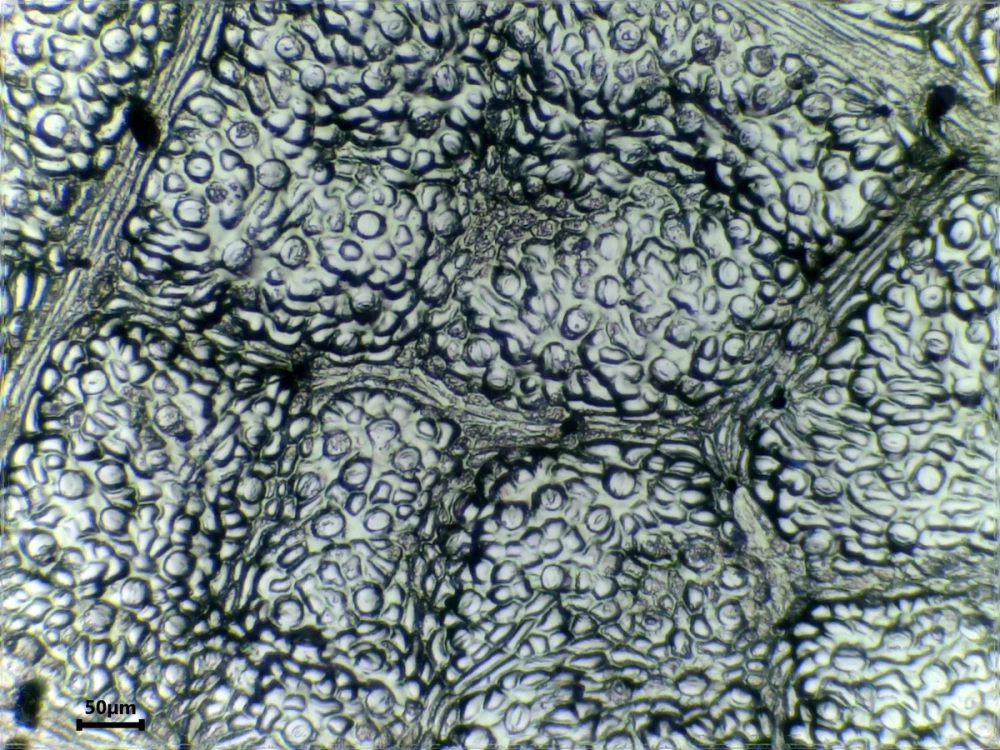 Quan sát các Tế bào biểu bì lá với hình dạng đa giác đặc trưng giúp bảo vệ các mô mềm bên trong.