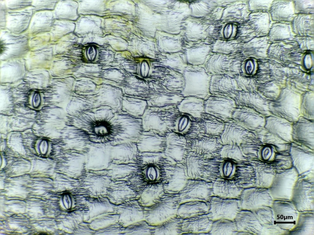 Sự phân chia Nhiễm sắc thể trong tế bào biểu bì diễn ra trong quá trình sinh trưởng và thay thế mô cũ.