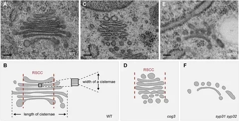 Bào quan hệ thống màng đóng vai trò bài tiết tế bào