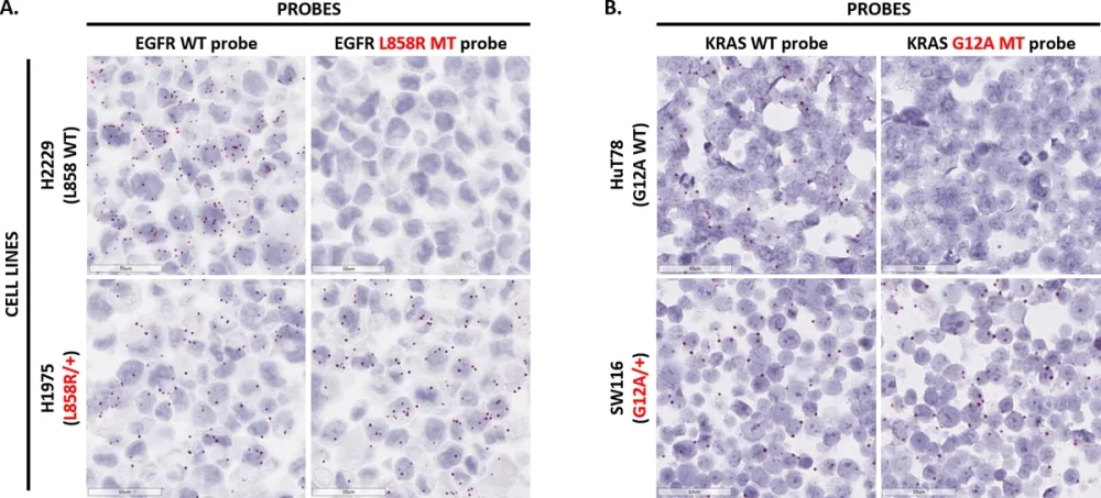 Cấu trúc hồng cầu bình thường và hồng cầu hình liềm