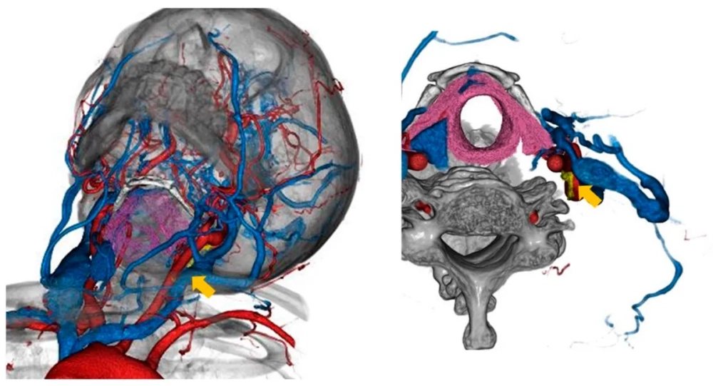 Giải phẫu dây thần kinh số X kết nối với các cơ quan