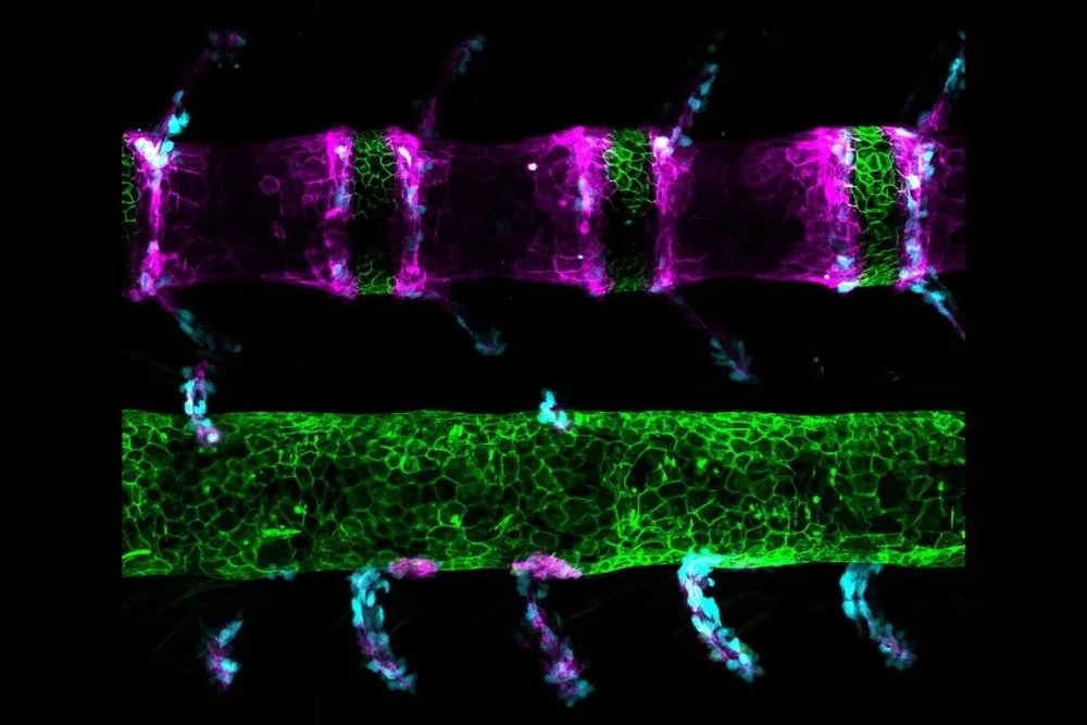 Quá trình đột biến sai nghĩa thay đổi axit amin trong chuỗi polipeptit
