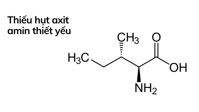 Nhóm axit amin thiết yếu bạn đang thiếu hụt