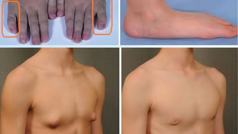 Dấu hiệu nhận biết dễ bị nam giới bỏ qua